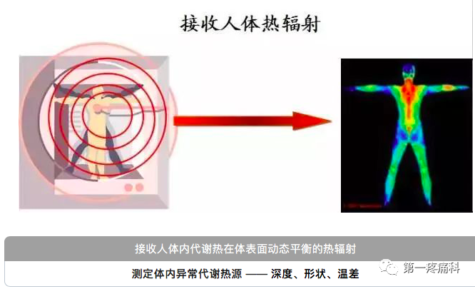 医用红外热像仪怎么开机神奇的仪器，红外热成像技术发现疾病早期状态_https://www.jmylbn.com_新闻资讯_第1张