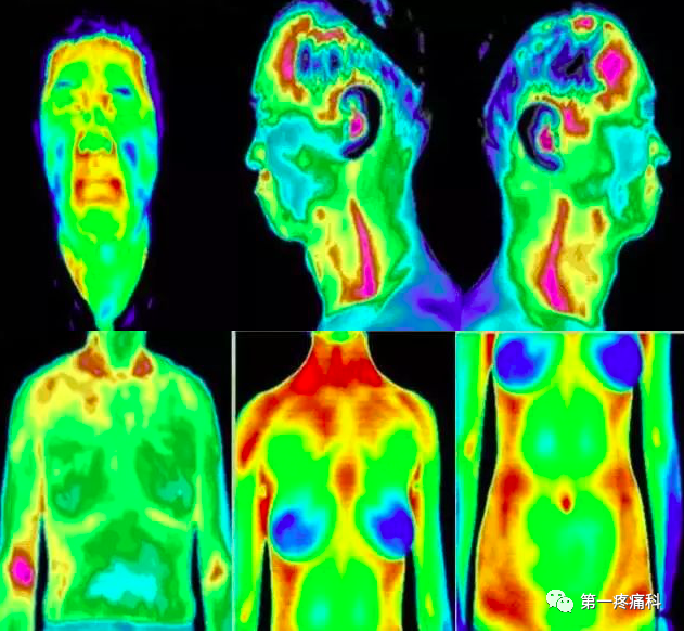 医用红外热像仪怎么开机神奇的仪器，红外热成像技术发现疾病早期状态_https://www.jmylbn.com_新闻资讯_第2张