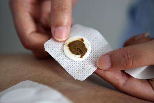 中药贴敷,采用中药制剂通过皮肤的渗透吸收,进入病变部位,达到治疗