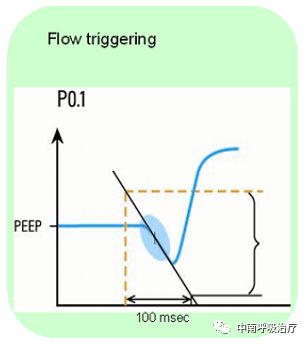 呼吸机呼气阀是什么有创机械通气上手指南：P0.1 监测_https://www.jmylbn.com_新闻资讯_第2张