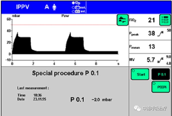 呼吸机呼气阀是什么有创机械通气上手指南：P0.1 监测_https://www.jmylbn.com_新闻资讯_第3张