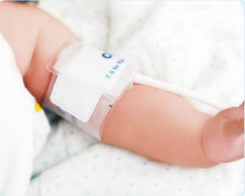 为什么新生儿的监护仪新生儿血压监测法宝——SunTech无创血压监测技术_https://www.jmylbn.com_新闻资讯_第1张