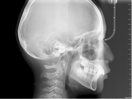 什么牌子口腔ct最好【口腔· 科普】CBCT（口腔CT）_https://www.jmylbn.com_新闻资讯_第15张