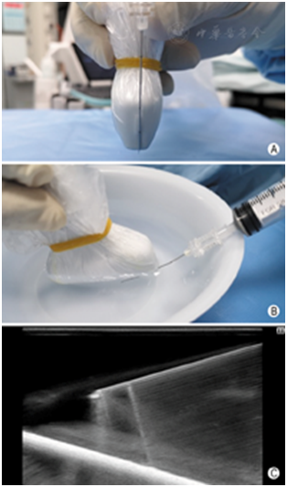 穿刺架怎么消毒超声引导下甲状腺结节细针穿刺细胞学检查实践指南(2019版)_https://www.jmylbn.com_新闻资讯_第13张