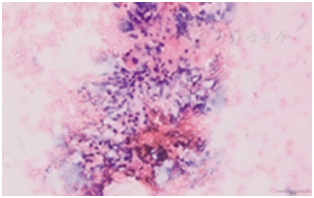 穿刺架怎么消毒超声引导下甲状腺结节细针穿刺细胞学检查实践指南(2019版)_https://www.jmylbn.com_新闻资讯_第24张