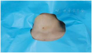 穿刺架怎么消毒超声引导下甲状腺结节细针穿刺细胞学检查实践指南(2019版)_https://www.jmylbn.com_新闻资讯_第10张