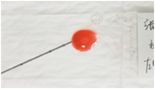 穿刺架怎么消毒超声引导下甲状腺结节细针穿刺细胞学检查实践指南(2019版)_https://www.jmylbn.com_新闻资讯_第22张