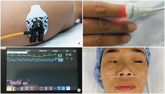 穿刺架怎么消毒超声引导下甲状腺结节细针穿刺细胞学检查实践指南(2019版)_https://www.jmylbn.com_新闻资讯_第4张