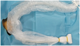 穿刺架怎么消毒超声引导下甲状腺结节细针穿刺细胞学检查实践指南(2019版)_https://www.jmylbn.com_新闻资讯_第7张