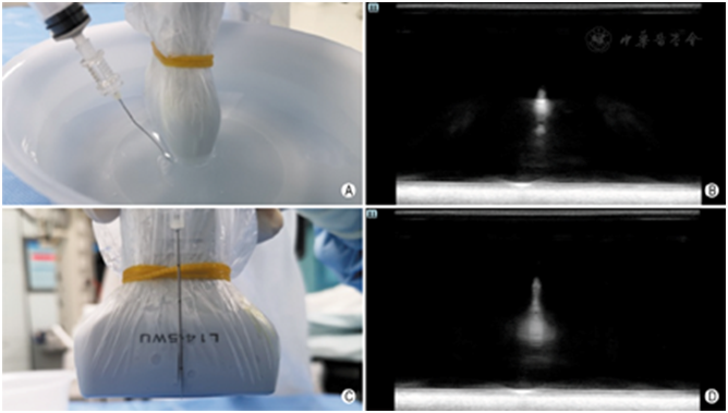 穿刺架怎么消毒超声引导下甲状腺结节细针穿刺细胞学检查实践指南(2019版)_https://www.jmylbn.com_新闻资讯_第14张