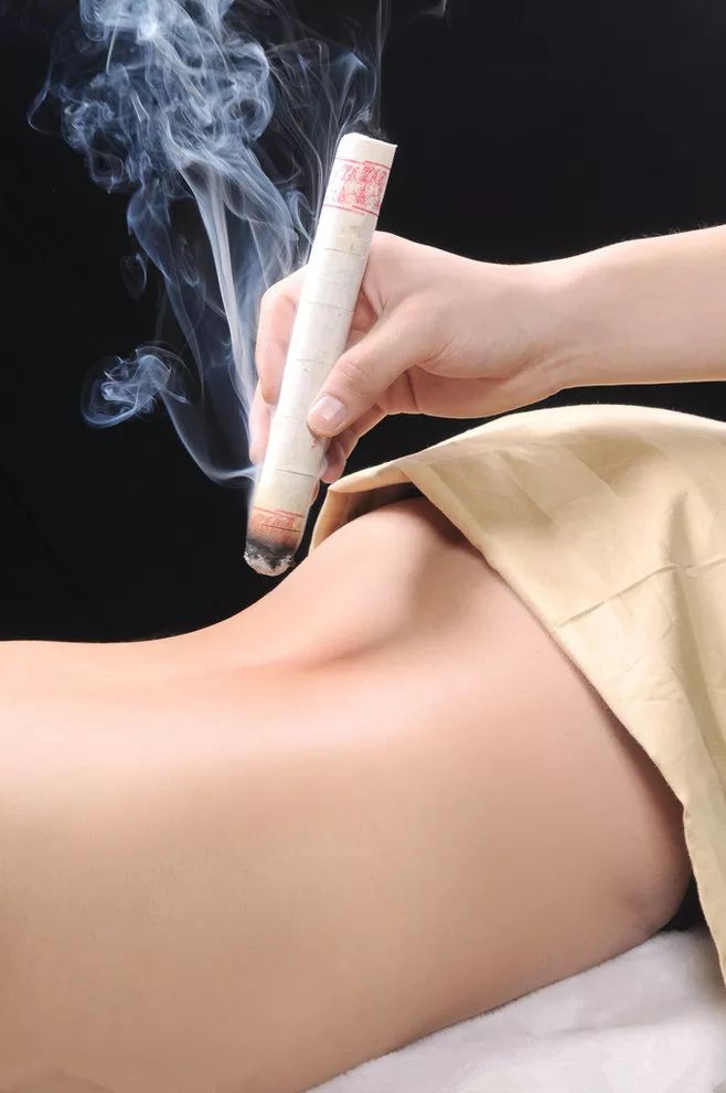 五穴艾灸助力女性驱寒.