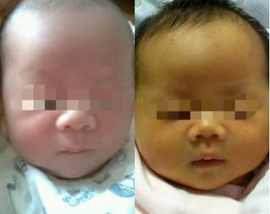 为什么要用光疗纸尿裤【精益管理】日间光疗门诊：呵护新生儿  不做“小黄人”_https://www.jmylbn.com_新闻资讯_第3张