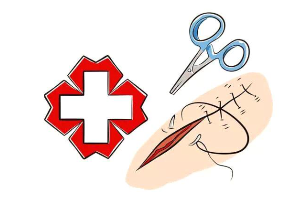 合成外缝线为什么贵科普视窗丨手术缝线知多少_https://www.jmylbn.com_新闻资讯_第2张