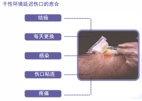 人工敷料怎么照顾伤口护理知识 ｜ 怎样能让伤口快速愈合？这几招学起来_https://www.jmylbn.com_新闻资讯_第6张