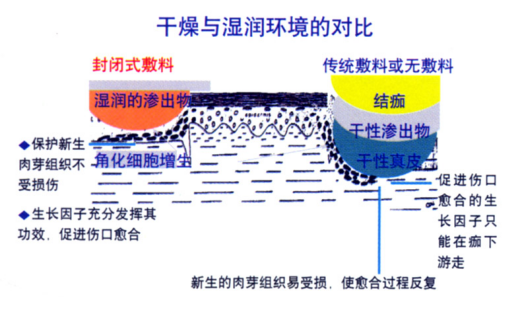 人工敷料怎么照顾伤口护理知识 ｜ 怎样能让伤口快速愈合？这几招学起来_https://www.jmylbn.com_新闻资讯_第7张