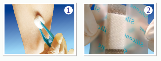 人工敷料怎么照顾伤口护理知识 ｜ 怎样能让伤口快速愈合？这几招学起来_https://www.jmylbn.com_新闻资讯_第15张