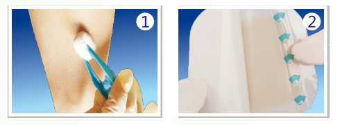 人工敷料怎么照顾伤口护理知识 ｜ 怎样能让伤口快速愈合？这几招学起来_https://www.jmylbn.com_新闻资讯_第10张