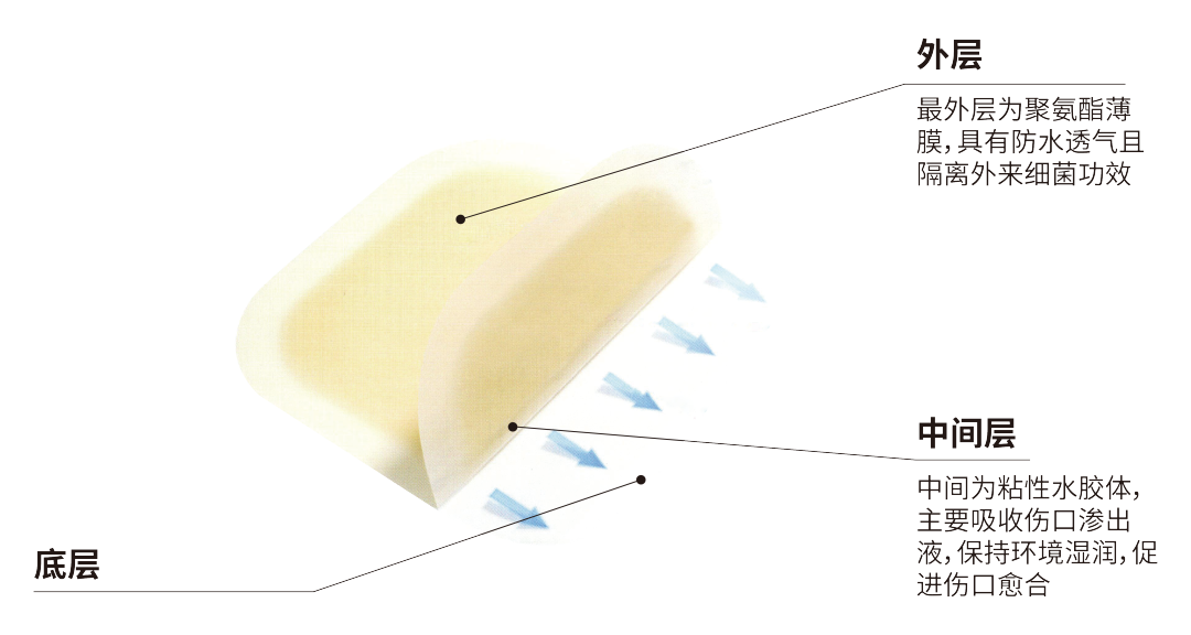 自粘伤口敷料有什么用护理大讲堂 ｜ 水胶体敷料如何促进伤口愈合？_https://www.jmylbn.com_新闻资讯_第8张
