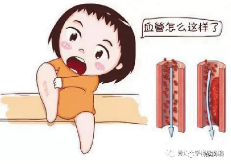 血栓泵是什么深静脉血栓预防处理及气压泵的使用_https://www.jmylbn.com_新闻资讯_第4张