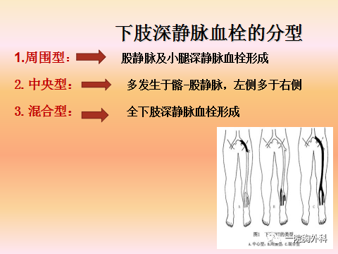 血栓泵是什么深静脉血栓预防处理及气压泵的使用_https://www.jmylbn.com_新闻资讯_第5张