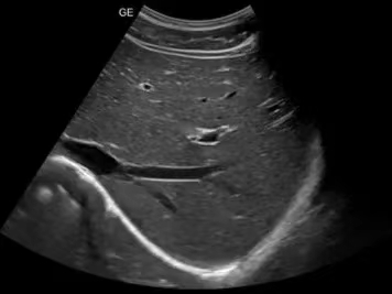 ct什么牌子的好【喜讯】瑶医医院影像科大型CT设备顺利开机并投入使用_https://www.jmylbn.com_新闻资讯_第14张