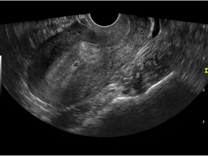 ct什么牌子的好【喜讯】瑶医医院影像科大型CT设备顺利开机并投入使用_https://www.jmylbn.com_新闻资讯_第13张