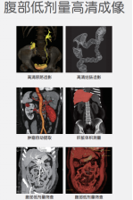 ct什么牌子的好【喜讯】瑶医医院影像科大型CT设备顺利开机并投入使用_https://www.jmylbn.com_新闻资讯_第9张