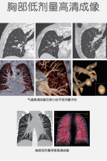 ct什么牌子的好【喜讯】瑶医医院影像科大型CT设备顺利开机并投入使用_https://www.jmylbn.com_新闻资讯_第8张