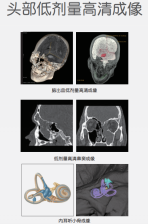 ct什么牌子的好【喜讯】瑶医医院影像科大型CT设备顺利开机并投入使用_https://www.jmylbn.com_新闻资讯_第7张