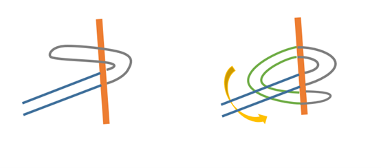 开睑器怎么用术说睛彩 ｜ 金海鹰教授：使用8-0缝线的无巩膜瓣人工晶体固定手术_https://www.jmylbn.com_新闻资讯_第5张