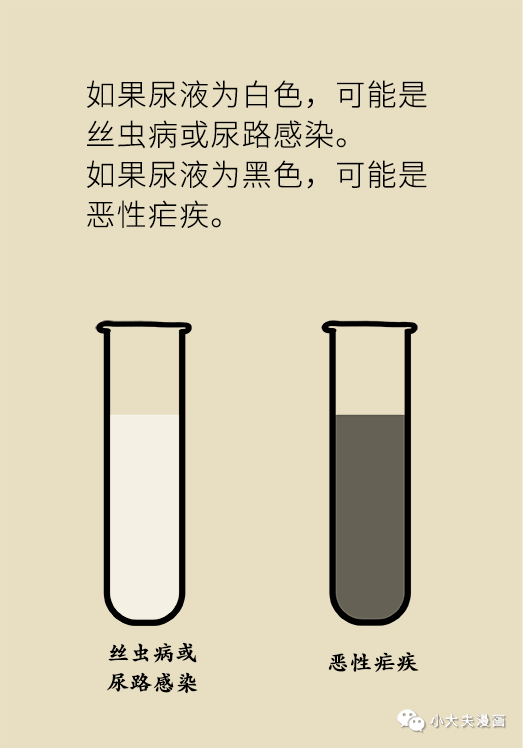 尿液出現這種顏色，可能你的身體正在發出求救信號！ 健康 第17張