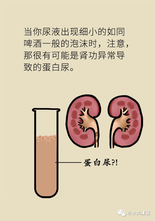 尿液出現這種顏色，可能你的身體正在發出求救信號！ 健康 第20張