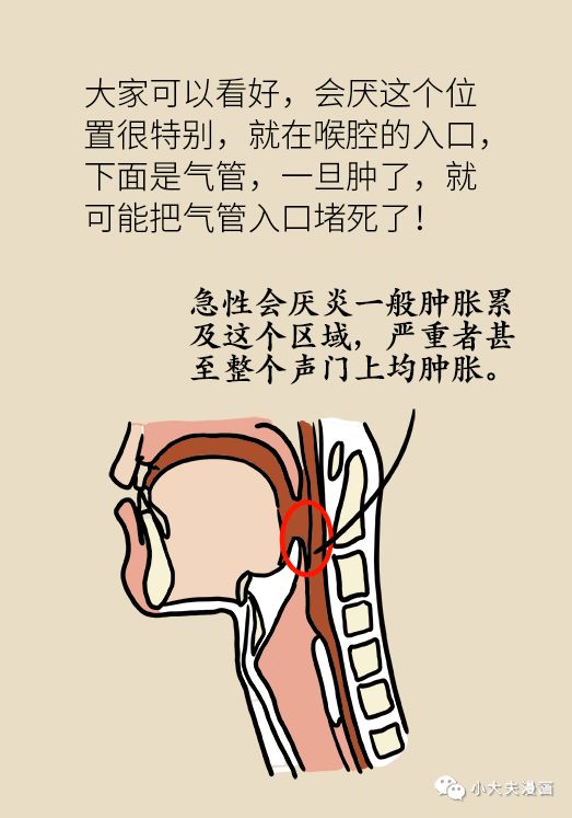 30歲女性嗓子疼險些喪命！醫生忠告，嗓子疼伴隨這五種症狀趕緊去急診！ 健康 第10張