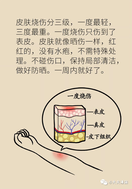 想要少留疤 烫伤后这样紧急处理就对了 Hi有料