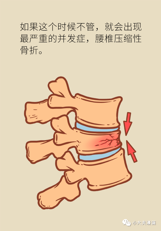 骨質疏松竟有這麼可怕的並發症，預防可不止補鈣這麼簡單！ 健康 第11張