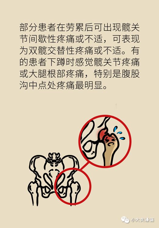 使用過激素，股骨頭就會走向壞死的深淵嗎？專家告訴你該怎麼辦！ 健康 第14張