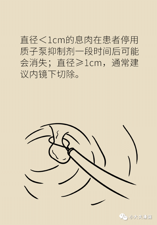 胃息肉是不是胃癌先兆？應不應該切？這些知識你必須知道 健康 第18張