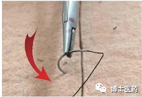 合成外缝线为什么贵医博士I 缝合材料的选择&缝合技巧_https://www.jmylbn.com_新闻资讯_第15张