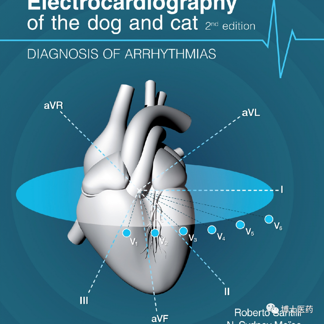 ecg导联脱落怎么办常见ECG导联连接异常分析_https://www.jmylbn.com_新闻资讯_第11张