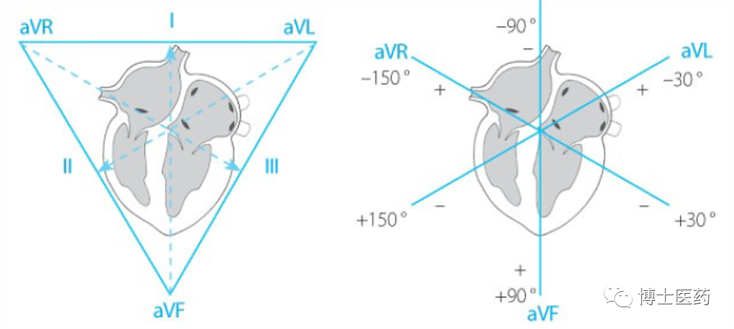 ecg导联脱落怎么办常见ECG导联连接异常分析_https://www.jmylbn.com_新闻资讯_第4张