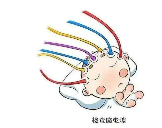 什么视频脑电图成妇儿科普 ｜ 视频脑电图是什么？哪些小朋友需要做？_https://www.jmylbn.com_新闻资讯_第1张