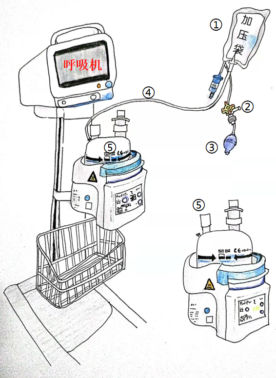 为什么呼吸机需要加湿“可视”“有感”专项治理在行动（十三）｜ 输液加压带  改善呼吸机加湿化水方式_https://www.jmylbn.com_新闻资讯_第8张