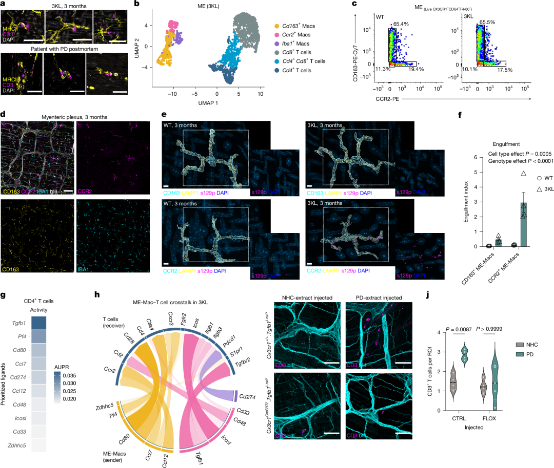 Fig. 4: ME-Macs and T cells interact by means of TGFβ1 in body-first PD models.