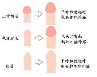 狼肚子怎么切割否，割否，包皮攻略_https://www.jmylbn.com_新闻资讯_第3张