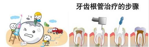 【西安现代医疗连锁机构】我怀孕了,牙疼的厉害,要去看医生吗?