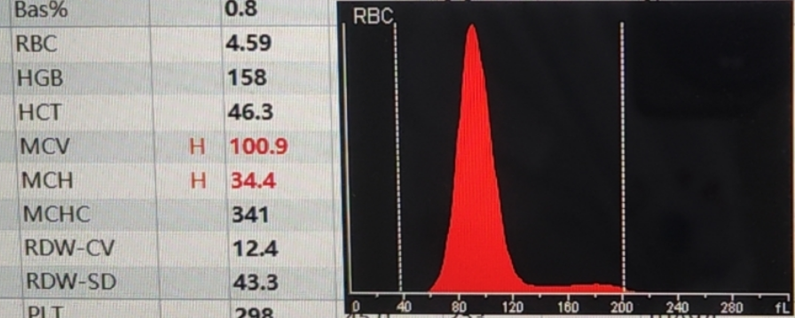 rbc直方图怎么看红细胞增多如何解读？红细胞直方图怎么看？看这篇就够了_https://www.jmylbn.com_新闻资讯_第11张