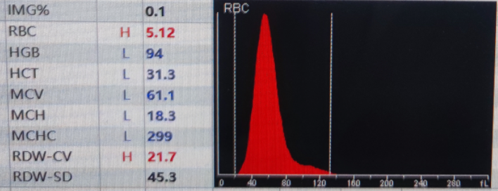 rbc直方图怎么看红细胞增多如何解读？红细胞直方图怎么看？看这篇就够了_https://www.jmylbn.com_新闻资讯_第7张