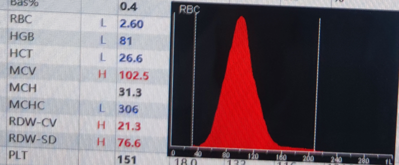 rbc直方图怎么看红细胞增多如何解读？红细胞直方图怎么看？看这篇就够了_https://www.jmylbn.com_新闻资讯_第12张