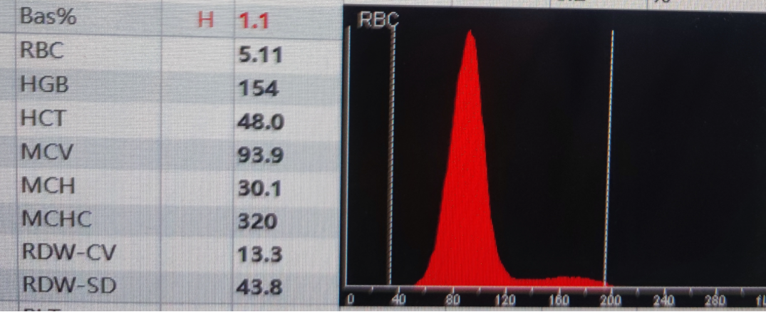 rbc直方图怎么看红细胞增多如何解读？红细胞直方图怎么看？看这篇就够了_https://www.jmylbn.com_新闻资讯_第5张