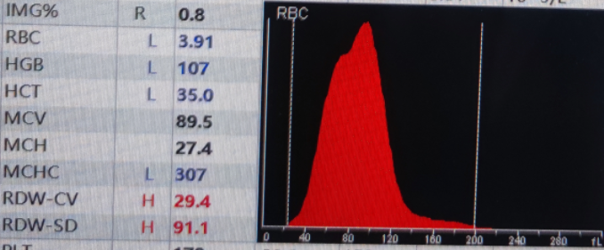 rbc直方图怎么看红细胞增多如何解读？红细胞直方图怎么看？看这篇就够了_https://www.jmylbn.com_新闻资讯_第9张